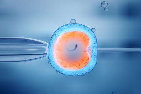 体外受精 IVF-ET